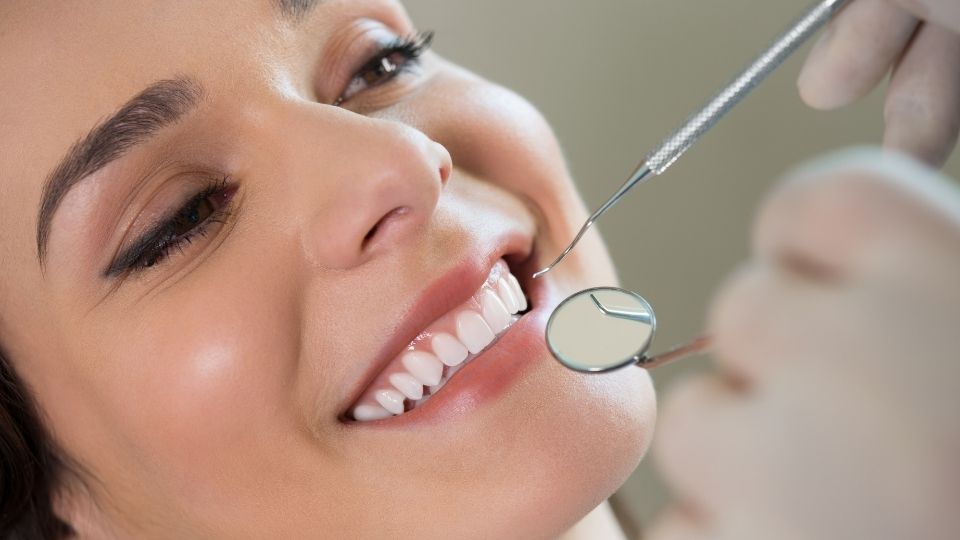 How To Maintain White Teeth After Professional Teeth Whitening