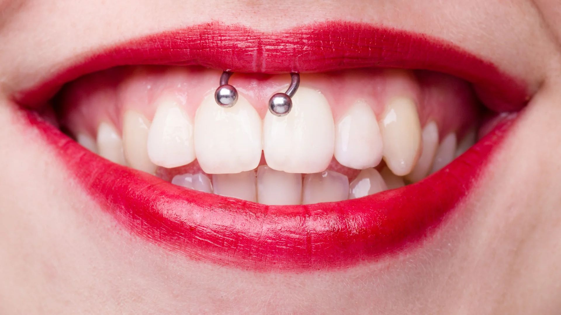 Can Oral Piercings Damage Your Smile? What You Need to Know