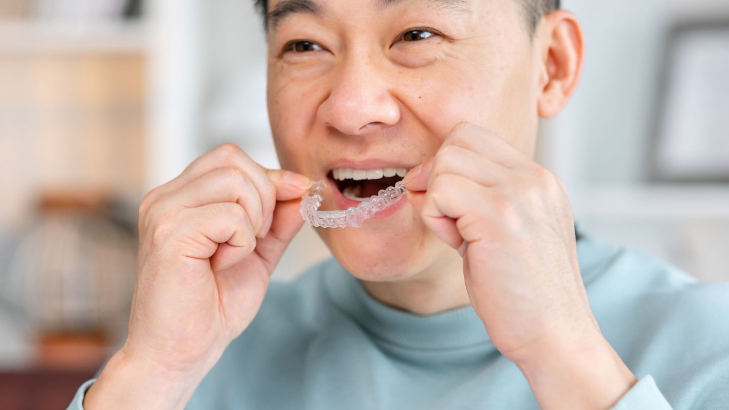 Man Using Clear Aligners